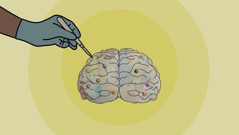 Die Illustration zeigt ein Gehirn mit einem Skalpell.