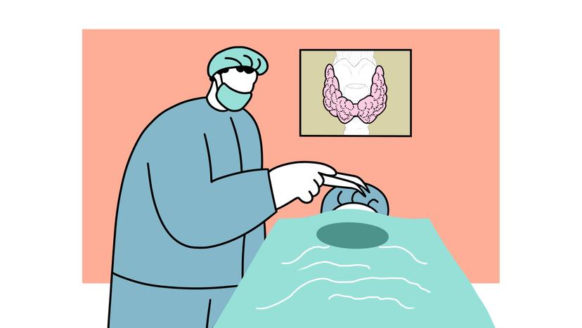 Die Illustration zeigt einen Chirurgen bei einer Operation an der Schilddrüse.