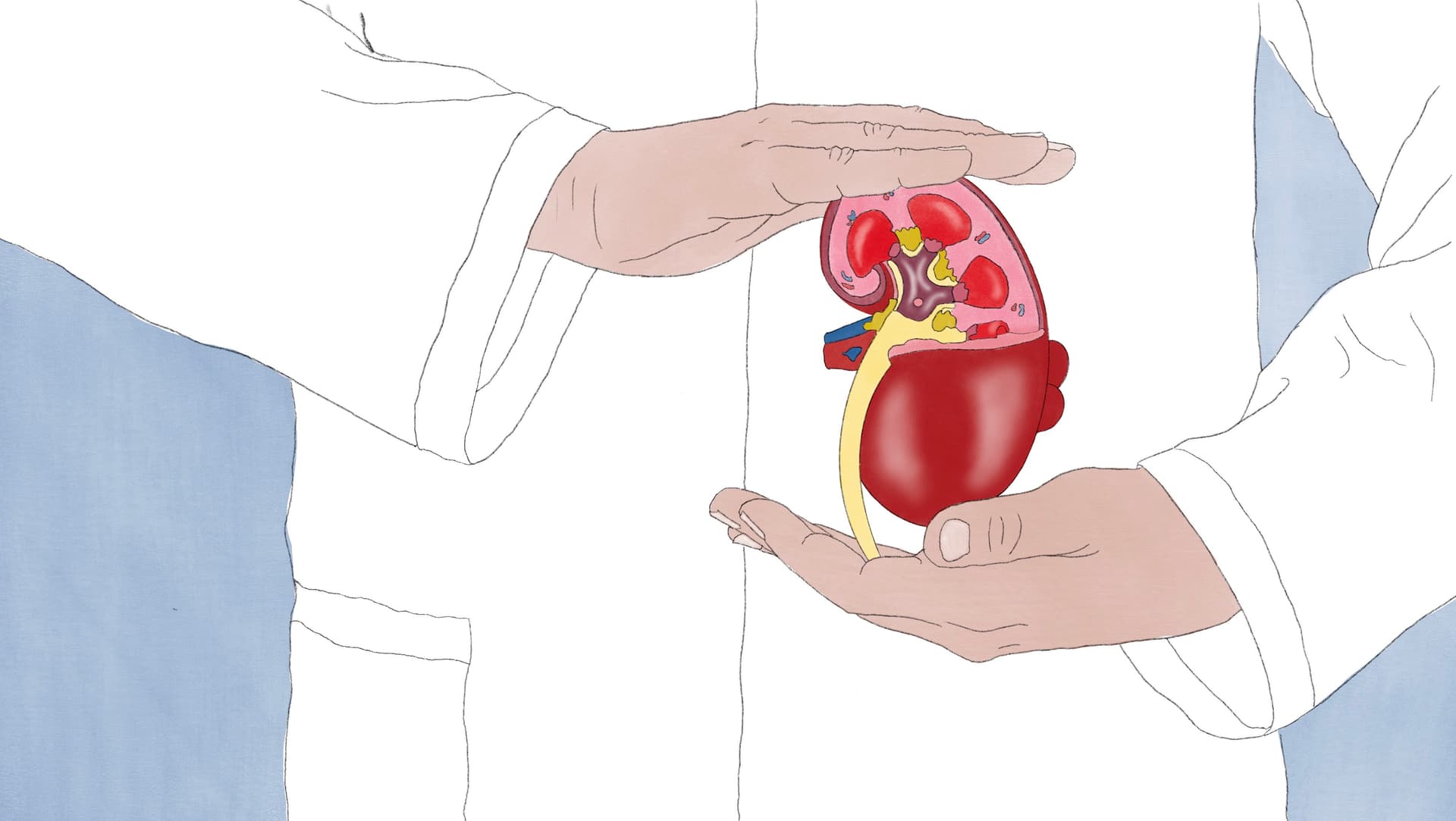 Die Nephrologie, eine Subdisziplin der Inneren Medizin, spielt eine entscheidende Rolle in der Prävention und Behandlung von Nierenerkrankungen. Die Illustration zeigt eine Niere in Händen eines Nephrologen.