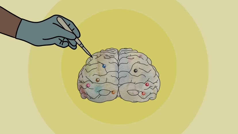 Die Neurochirurgie ist ein medizinisches Fachgebiet, das sich mit der Behandlung von Erkrankungen und Verletzungen des Nervensystems befasst, darunter das Gehirn, das Rückenmark und die peripheren Nerven. Die Illustration zeigt ein Gehirn mit einem Skalpell.