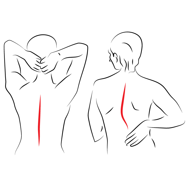 Das Bild zeigt eine Frau mit Rückenschmerzen