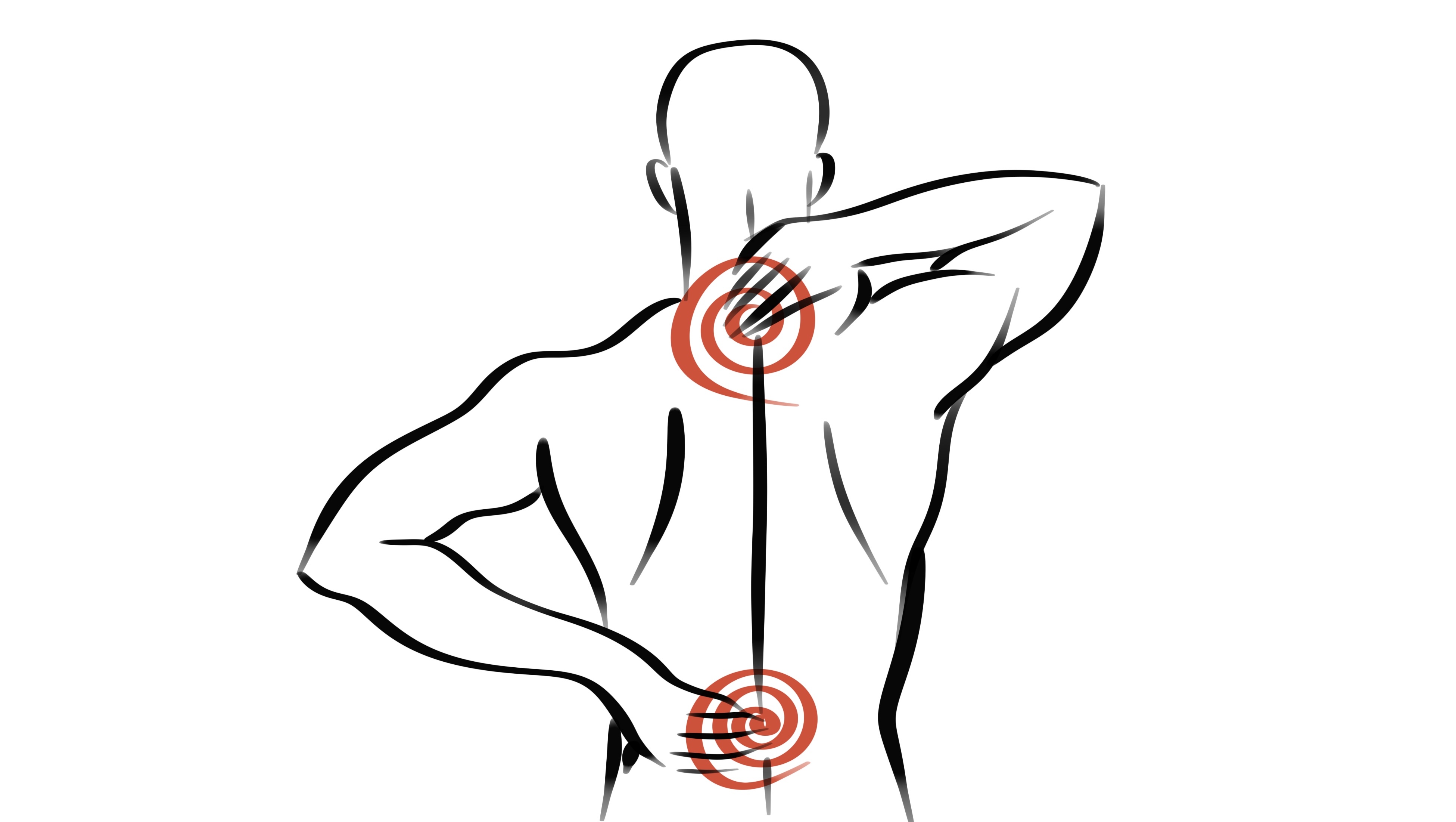 Die Illustration zeigt den Rücken einer Person mit rheumatologisch neuralgischen Stellen.