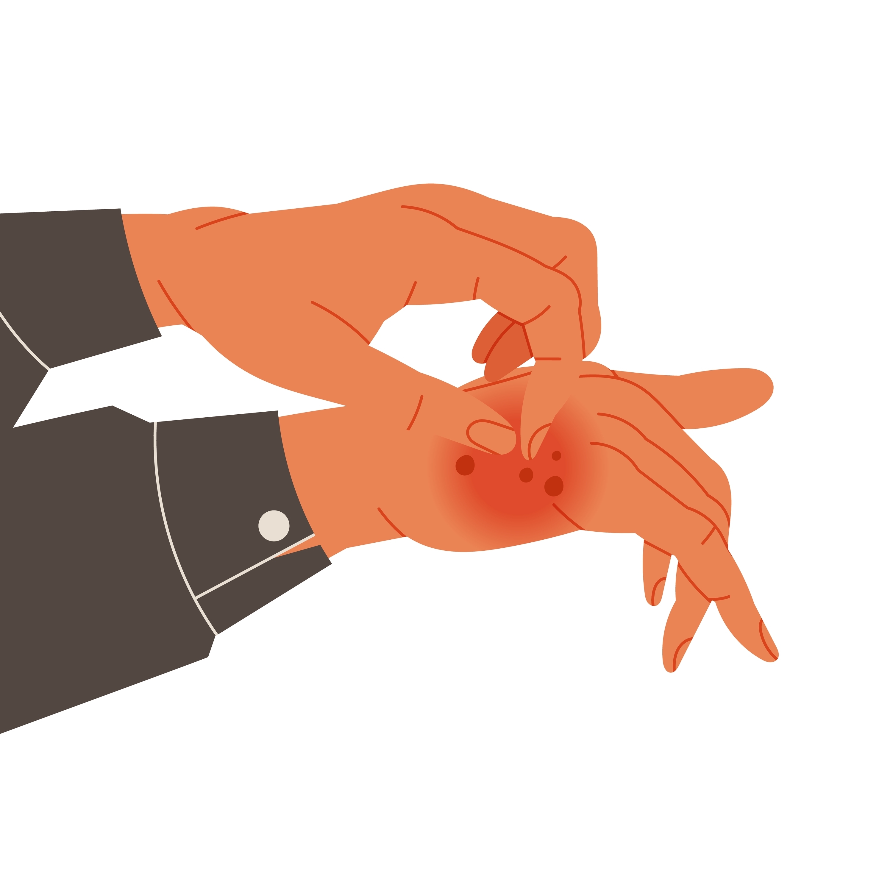 Die Illustration zeigt eine Hand die die andere an Neurodermitis erkrankte Hand kratzt.